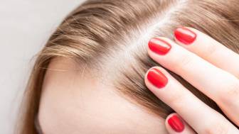 Haarausfall bei Frauen: Was hilft?