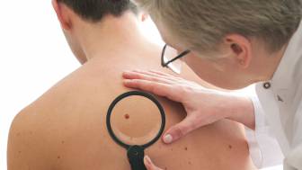 Hautkrebs-Vorsorge: Kostenlose Untersuchung alle zwei Jahre