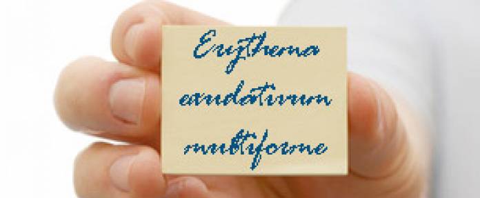 Erythema exsudativum multiforme