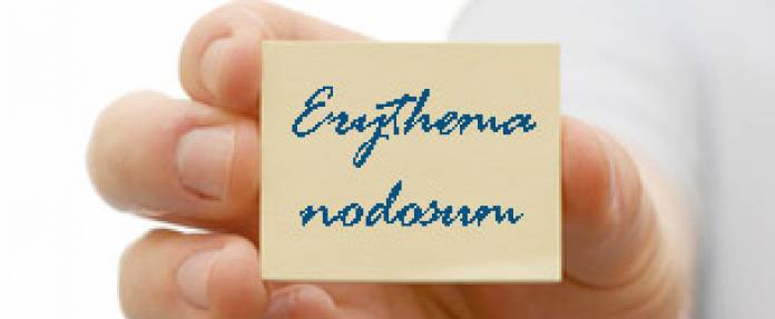 Erythema nodosum