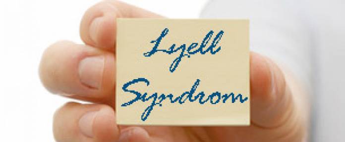 Lyell-Syndrom
