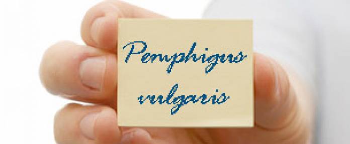 Pemphigus vulgaris