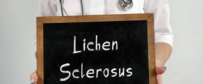 Lichen sclerosus